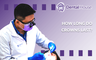 How Long Do Crowns Last?
