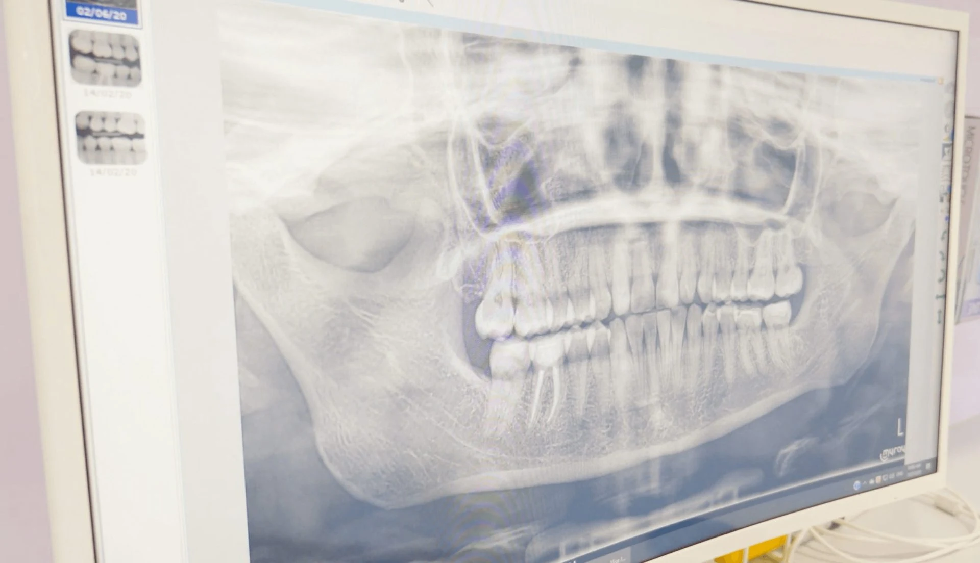 Dental House Group Dental Implant 1 1