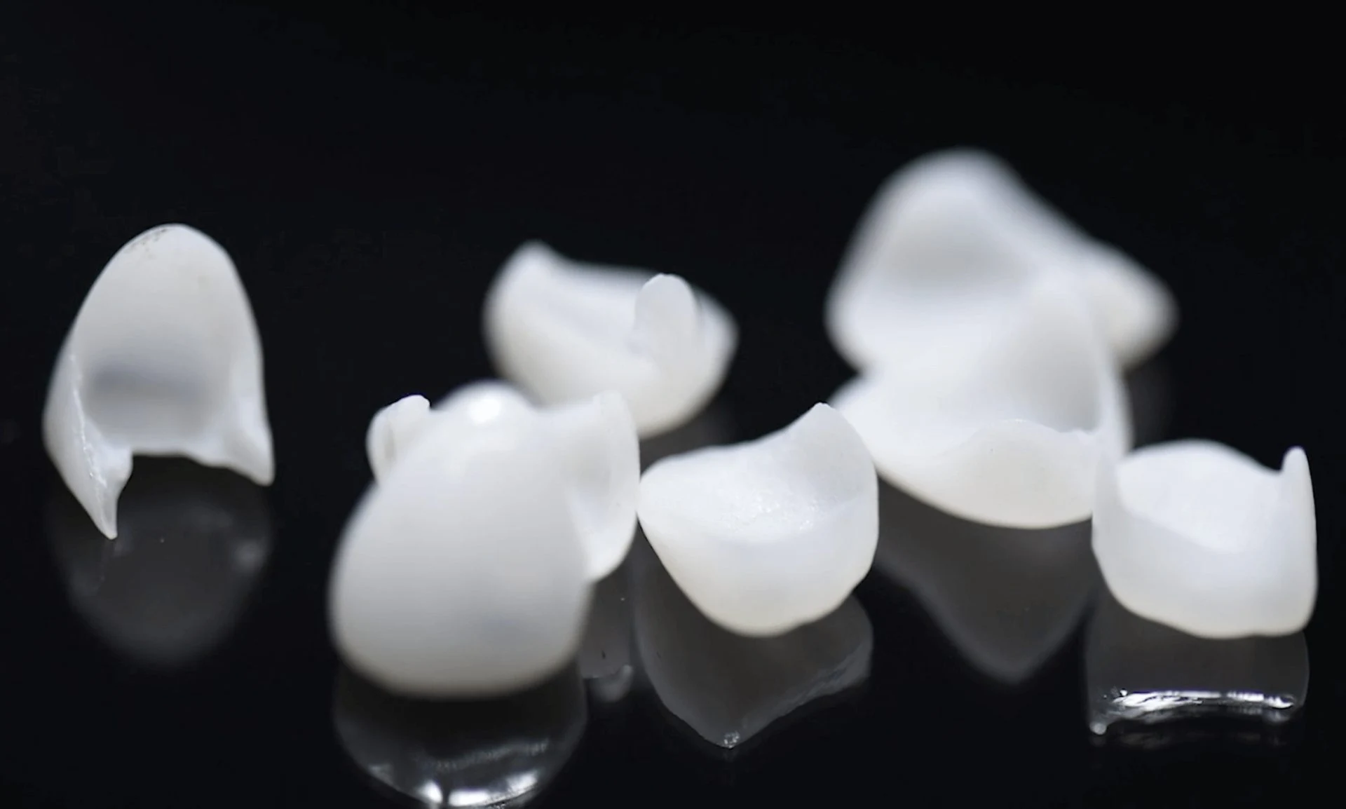 Dental House Group Dental Veneers 1