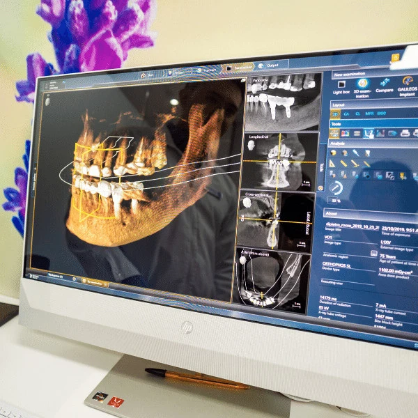 Dental Implant Melbourne Dental House