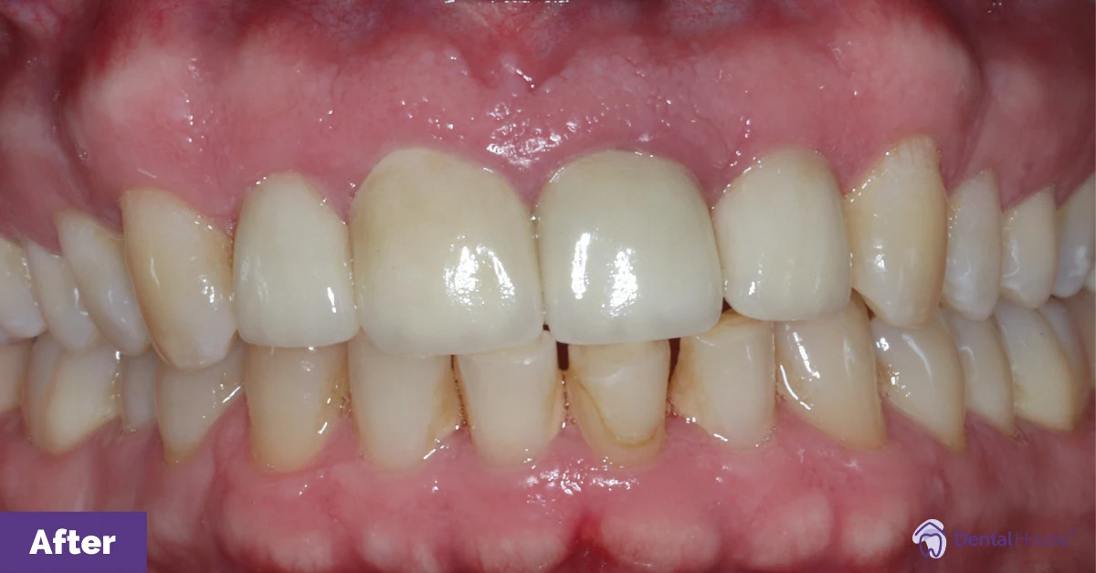 E’s Porcelain Veneers in Gisborne Gallery image