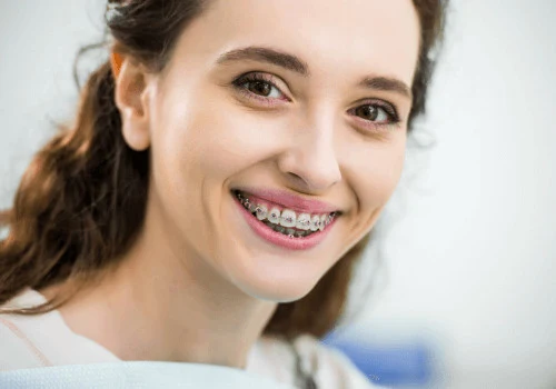 How to Fix Crooked Teeth 500x350 1 1