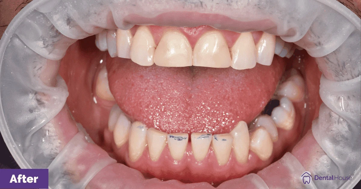Ian’s Smile Makeover in Gisborne Gallery image