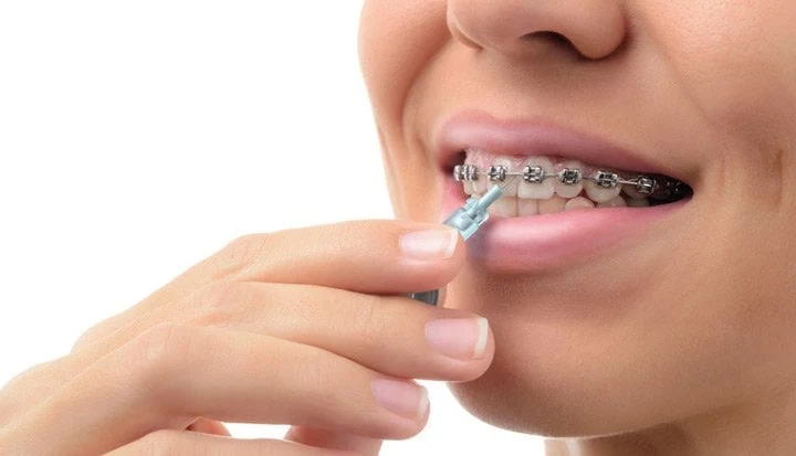 Oral Care During Orthodontic Treatment svg%3E