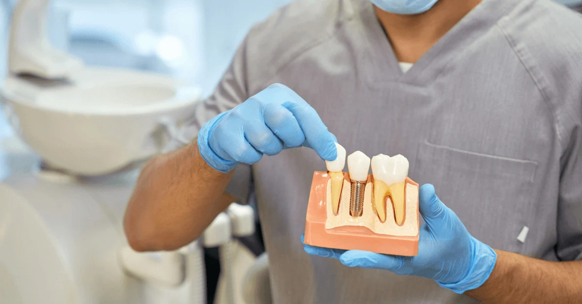 What Is the Warranty of Dental Implants Melbourne Dental House Group