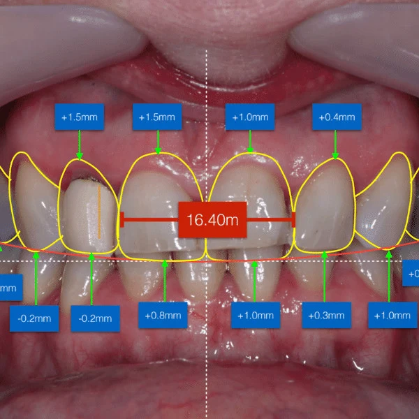 digital smile design at dental house group